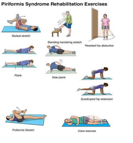 Piriformis Syndrome Exercises - Stretching, Strengthening & Foam