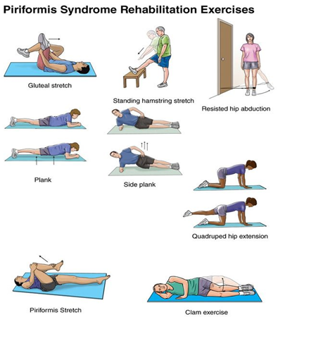 Piriformis syndrome causes and treatment with 6 exercises